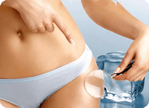 vet bevriezen amsterdam